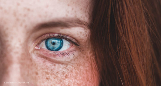 Frau mit blauen Augen, roten Haaren und Sommersprossen © Erik Mclean – unsplash.com